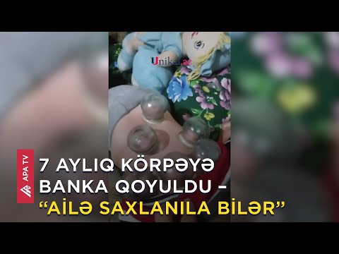 7 aylıq uşağa 6 banka qoyuldu – Pediatr: Çox dəhşətli görüntüdür – APA TV