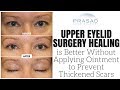 Why Anti-Scar Creams Should Not be Used During Upper Eyelid Surgery Healing