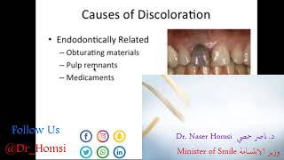 محاضرة عن اسرار و طرق تبييض الاسنان