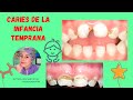 Caries de la infancia temprana 🦷