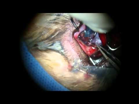 Dermoid Cyst on the cornea of a 6 year-old German Shepherd
