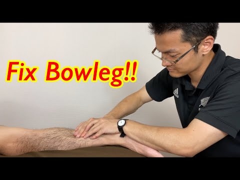 Video: Kako imeti bowlegs?