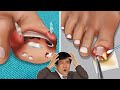 ASMR Help Jackie Chan remove a piece of glass stuck in his leg while filming
