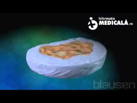 Video: Boli și Tratamentul Discului