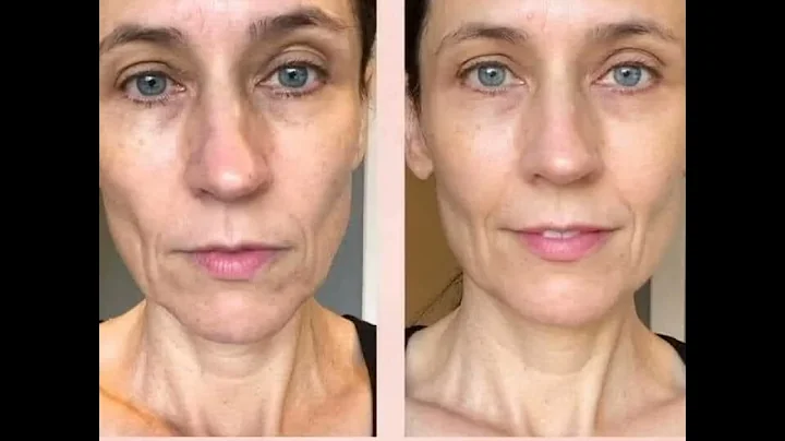 Liquid Marine Collagen - Look at these results!