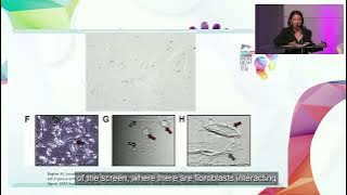 Fascia Science: Its Relation to EDS & HSD with Dr. Tina Wang - 2024 GLC