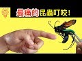 世界上前十名【咬人最痛】的昆蟲叮咬！