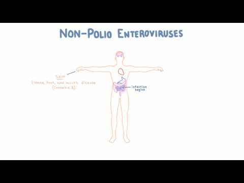 Video: Enterovirus Infection - What Is It? Symptoms And Treatment