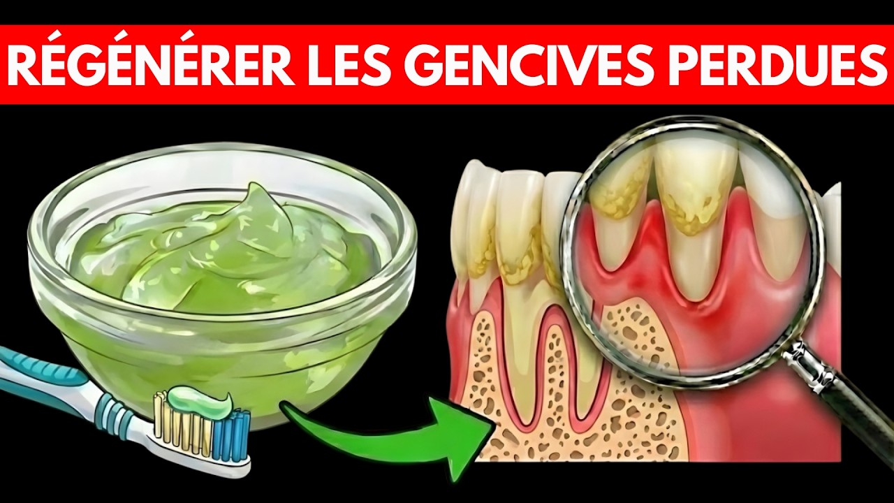 7 SECRETS POUR RÉGÉNÉRER LES GENCIVES QUE VOTRE DENTISTE NE VOUS DIT PAS