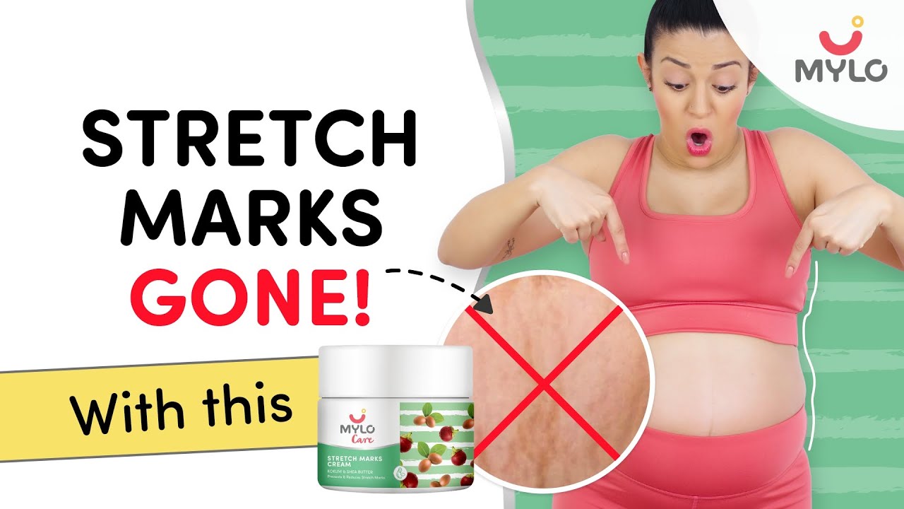 This Is The Best Kept Secret For Stretch Marks Remove Stretch Marks
