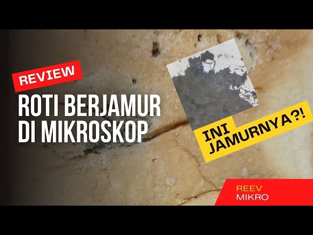 Review Roti Berjamur di Mikroskop?!! Hasilnya Luar Biasa!!! class=