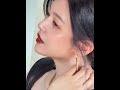 陈妍希分享脚伤康复进展