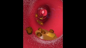 Thumbnail of What Happens When You Drink? Alcohol's Journey Through Your Body 🍷 (3D Animation)