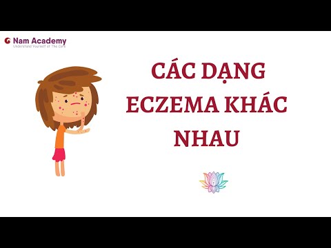 Video: Lời khuyên hàng đầu cho da dễ bị eczema