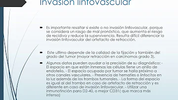 ¿Cuáles son los factores pronósticos?