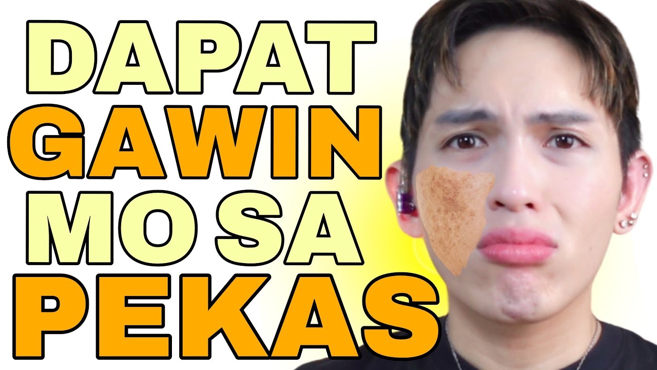 PAANO MAWALA ANG MELASMA / PEKAS? SIR LAWRENCE
