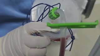 Diario Da Minha Cirurgia Tudo Certo