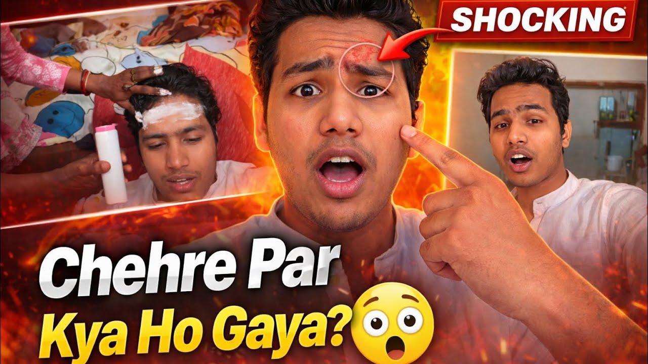 Chehre Par Kya Ho Gaya?😃चेहरे पर क्या हो गया ?😱