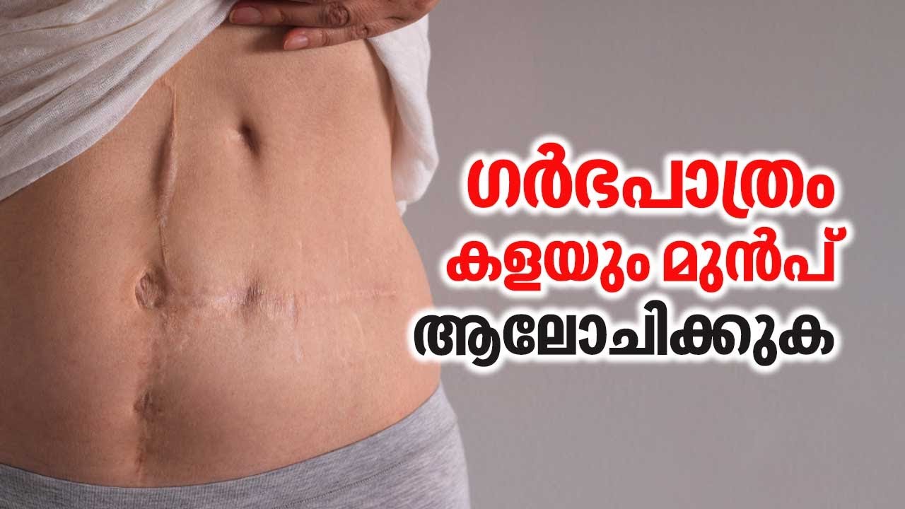 ഗർഭപാത്രം കളയും മുൻപ് ആലോചിക്കുക | Uterus Removal | Uterus Problem