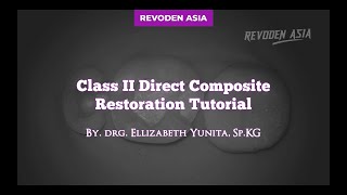 ‼️CLASS II DIRECT COMPOSITE RESTORATION TUTORIAL WITH  BIOFIT BY BIOCLEAR SECTIONAL MATRIX‼️