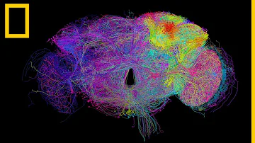 ¿Tienen cerebro las moscas de la fruta?