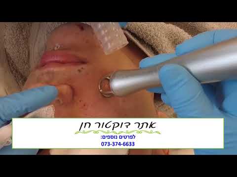 הסרת נגעי עור / סרחי עור בלייזר המתקדם בעולם ללא צלקת ובפריסה ארצית | אתר דוקטור חן