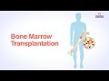 Bone Marrow Transplant | Patient Education | Yashoda Hospitals Secunderabad