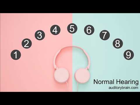 Sound Localization (simulated Unilateral Hearing Loss)