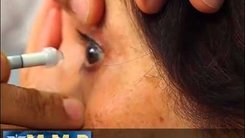 Immersion Ascan using PalmScan and EZ tip Immersion soft shell
