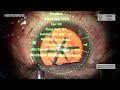 Live Cataract Surgery by Dr Gaurav Luthra