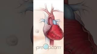 Cardiac Catheterization