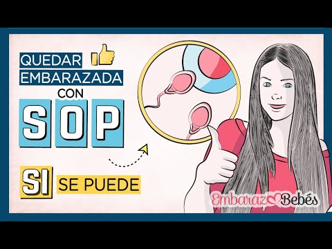 Video: Cómo quedar embarazada con síndrome de ovario poliquístico (SOP)