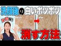 【角栓ケア】白いポツポツの『正体』『原因』『なくす方法』解説❗️一生角栓に悩まない方法【永久保存版】