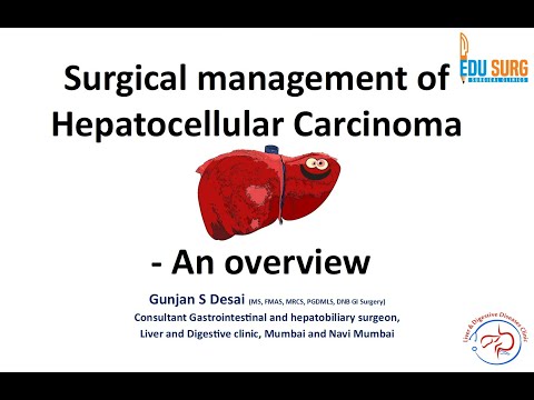 Primary liver cancer / Hepatocellular carcinoma treatment - Dr. Gunjan Desai - Edusurg Clinics