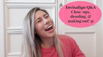 Invisalign Q&A -Cost, Kissing, Was It Worth It?!