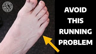 Avoid This Running Problem  Physical Therapy for Lateral Foot Pain