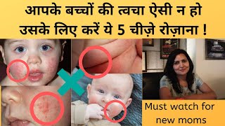 बच्चों की कोमल त्वचा के लिए देखभाल कैसे करें |How to take care of your baby skin |My Baby Care screenshot 5