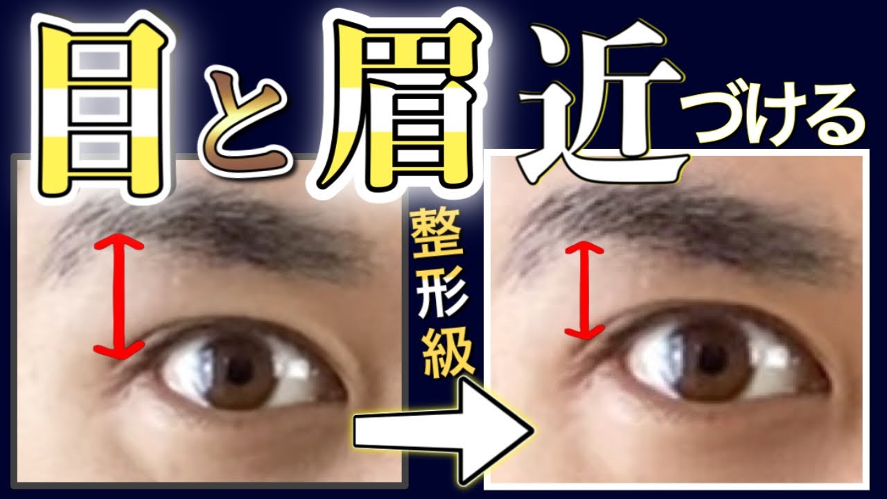 【一瞬】目と眉毛の間を近づける方法!【整形級/超簡単!】 YouTube 【一瞬】目と眉毛の間を近づける方法!【整形級/超簡単!】 YouTube