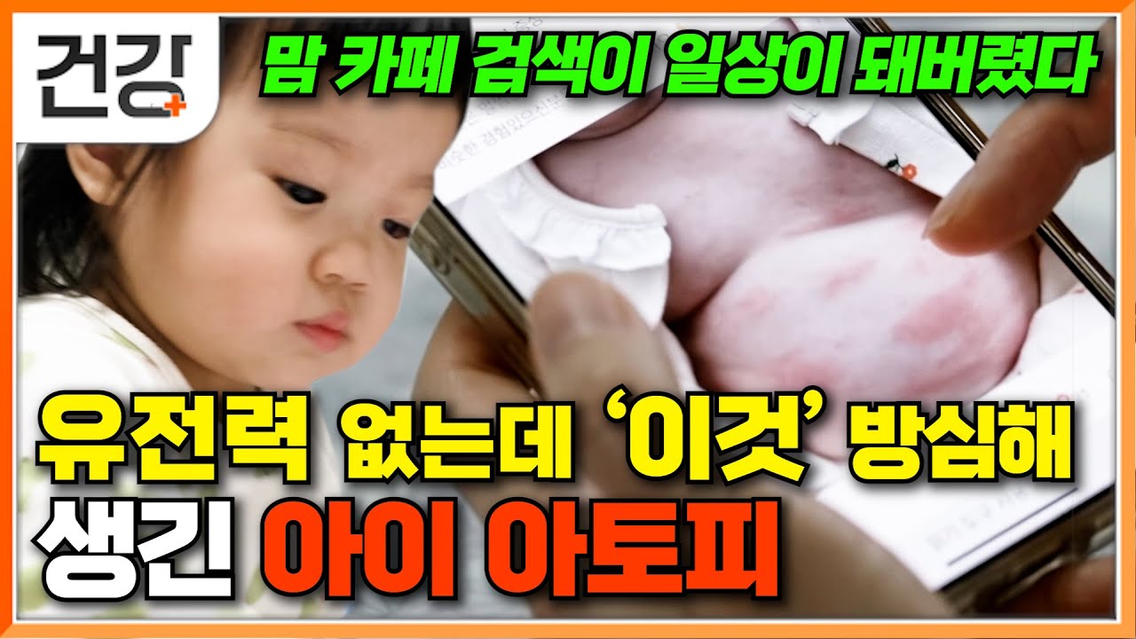 인터넷의 수많은 영유아 아토피 정보로도 안 낫던 아이│16개월 아기에게 갑자기 아토피가 생긴 이유│'이렇게' 먹고, 실천했더니 낫기 시작한 피부│귀하신 몸│#EBS건강