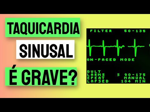 Vídeo: Taquicardia Sinusal: Normal Vs. Inadequada, Causas, Tratamento