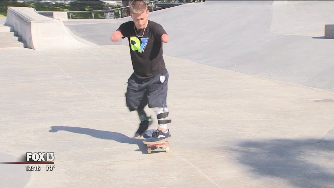 Adaptive skateboarder overcomes the odds -- and hopes you do, too