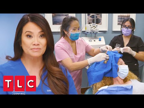 Helping a Patient Covered in Pilar Cysts | Dr. Pimple Popper