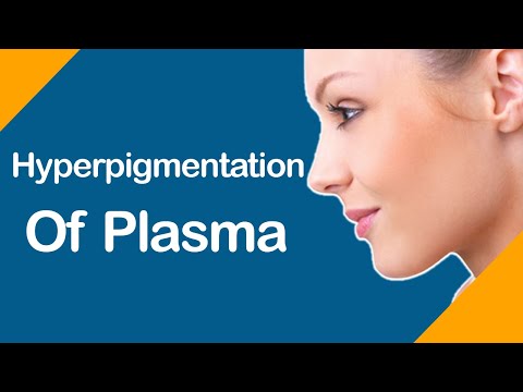 Hyperpigmentation of Plasma