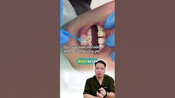 Hết khe thưa – Nụ cười kín khít tự nhiên #drThu #BsThu #Dansuthammy #Veneer