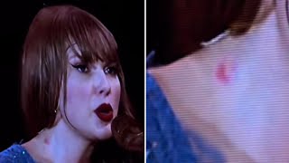 Taylor Swift Spotted With HICKEY From Travis Kelce ONSTAGE at the Eras Tour Stockholm