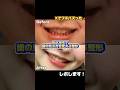 【超満足💯】2万円で歯の見え方を変えるプチ整形🇯🇵#ボトックス #美容整形