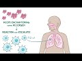 Atopic dermatitis (eczema) - causes, symptoms, diagnosis, treatment, pathology