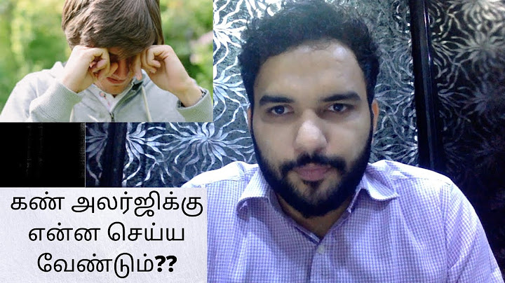 What should you do for Eye Allergy?? | Tamil | Dr. Syed Moosa | Eye Doctor |