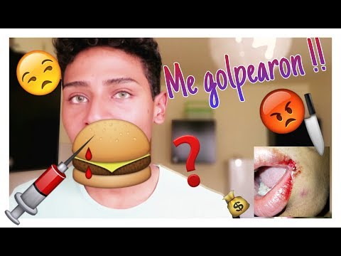 Me pegaron en la cara! -Jeremy Vlogs-