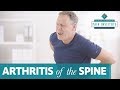 Treatment for Arthritis of the Spine